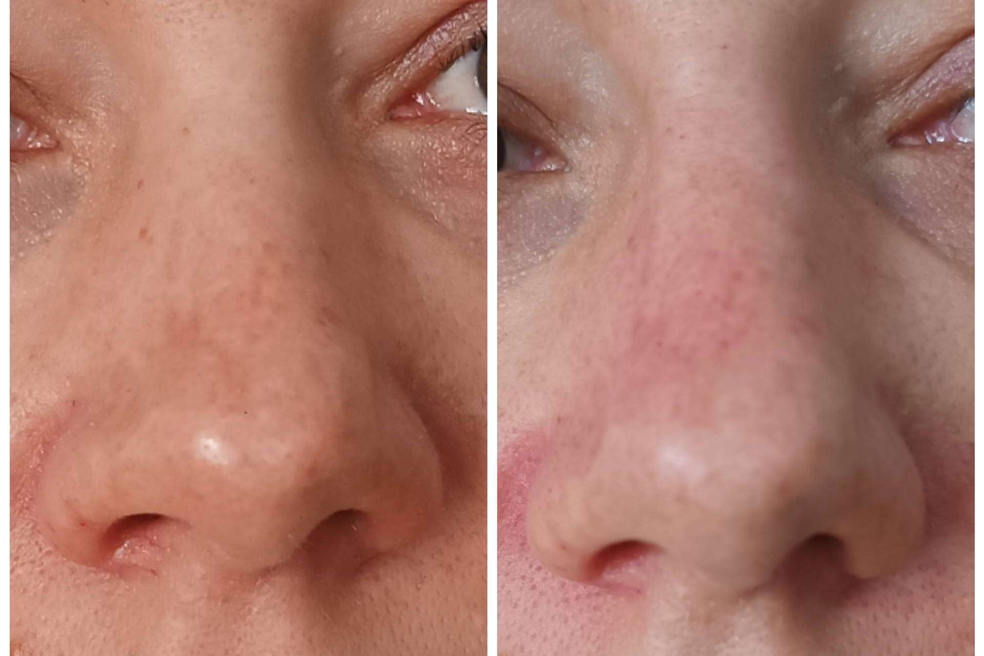 Medicina estética facial y dental para una sonrisa perfecta de la mano de Clínica Calvo de Mora
