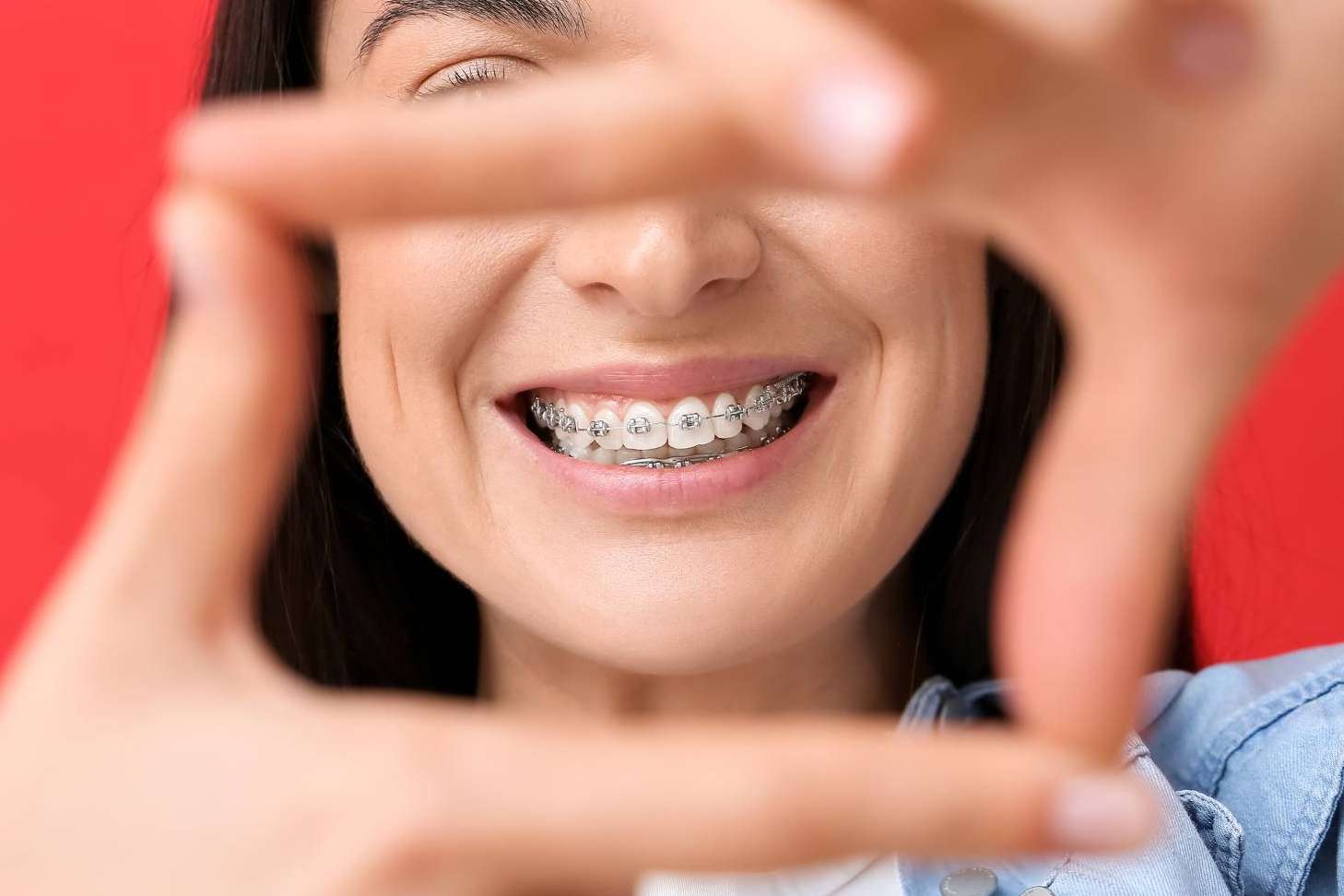 7 aspectos que valorar cuando se busca uno de los mejores dentistas de Madrid