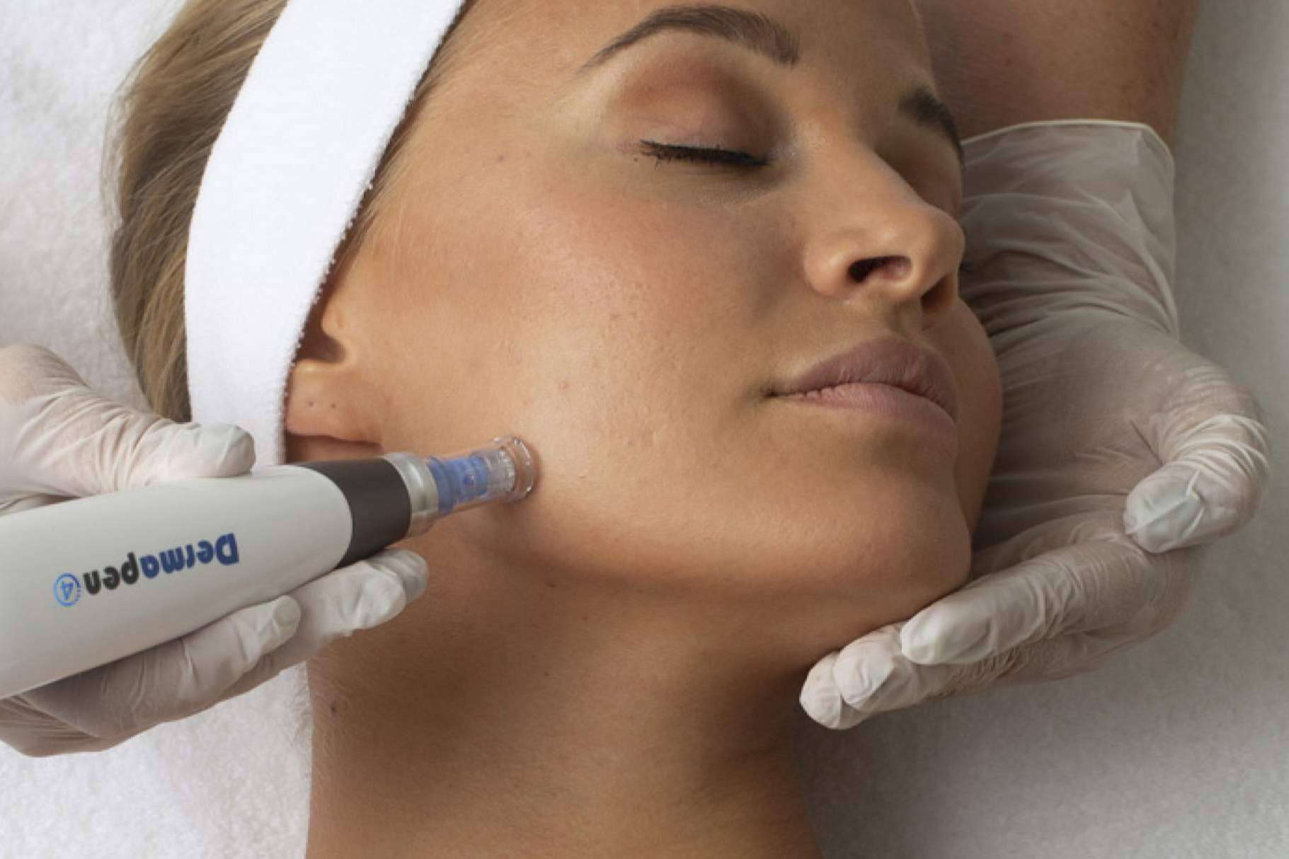 DERMAPEN™ de THR, es el microneedling médico estético por excelencia