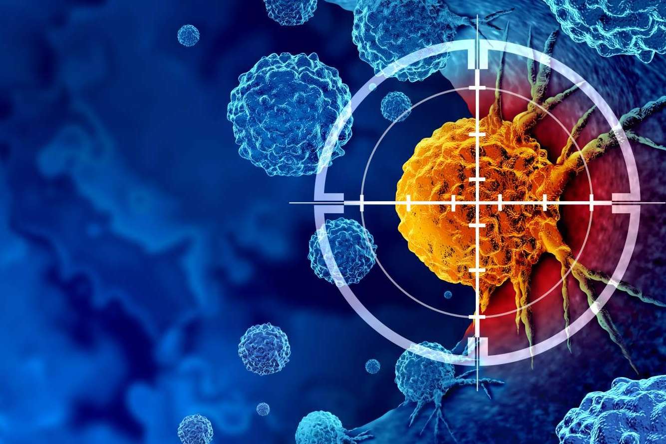 Oncocit; Innovación global en inmunoterapia personalizada para el tratamiento del cáncer