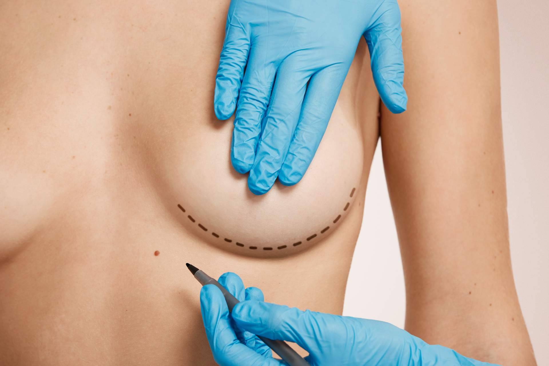 Beauty & Beauty refuerza su presencia con su clínica de cirugía estética en Tenerife y Algeciras