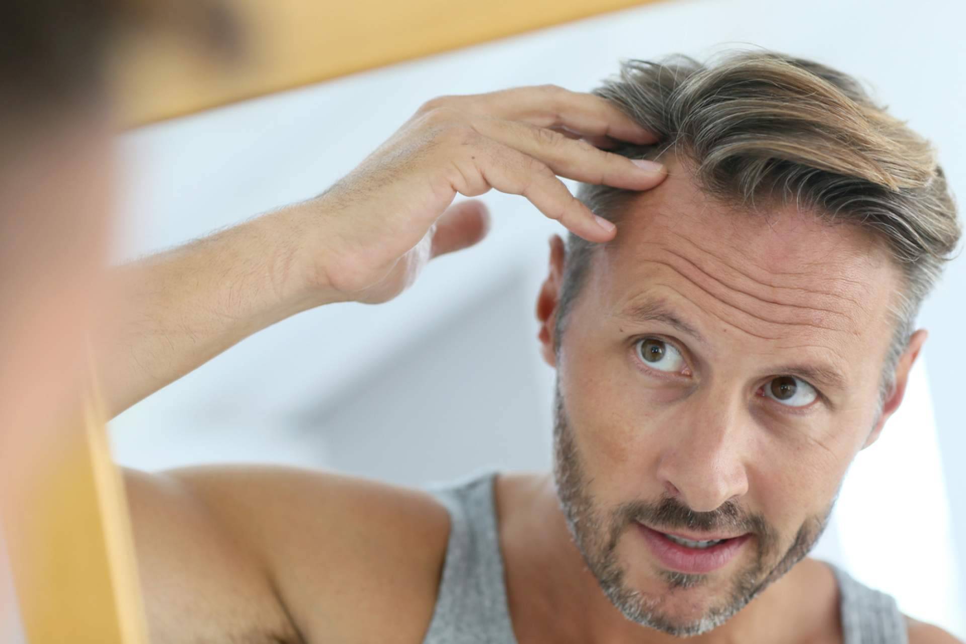 Salud capilar con Xpecia Tablet; El suplemento clave para fortalecer el pelo